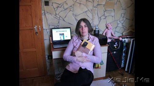 11个让你改观的“雨人”患者 (3)